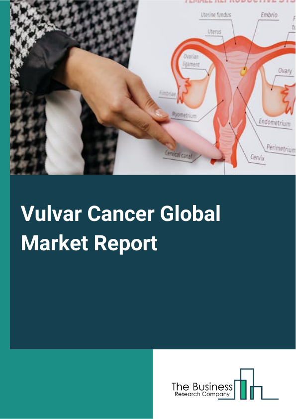 Global Vulvar Cancer Market Report 2025