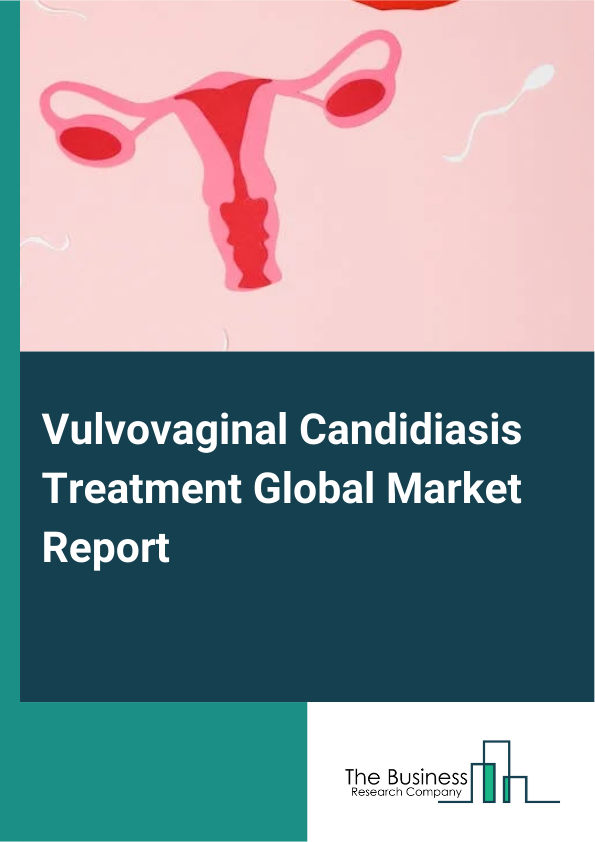 Global Vulvovaginal Candidiasis Treatment Market Report 2025
