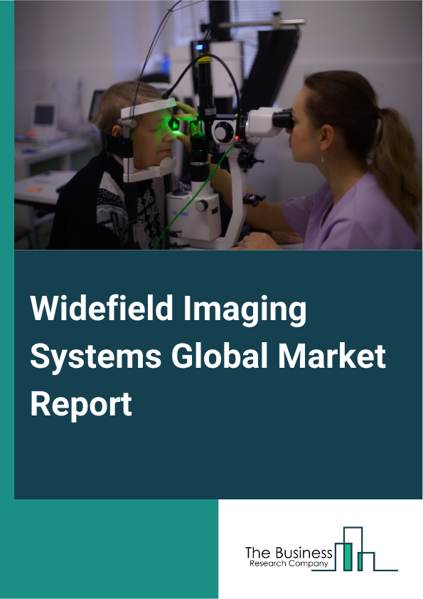 Global Widefield Imaging Systems Market Report 2025