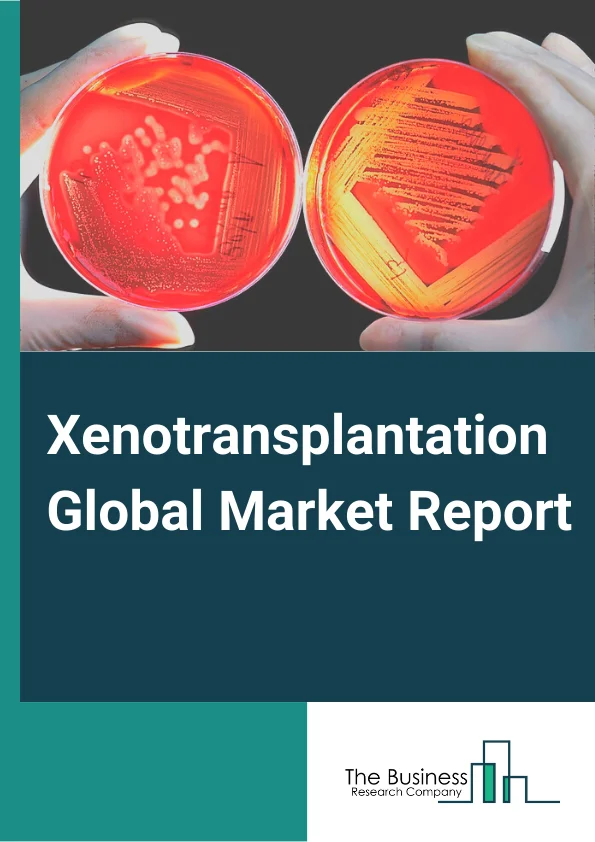 Global Xenotransplantation  Market Report 2024